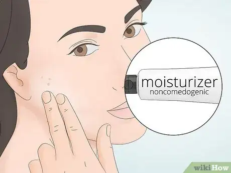 Image titled Clear Pustules on Your Face Step 4