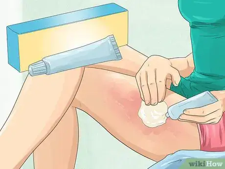 Image titled Treat Erythrodermic Psoriasis Step 3