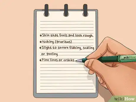 Image titled Diagnose the Cause of Dry Skin Step 2