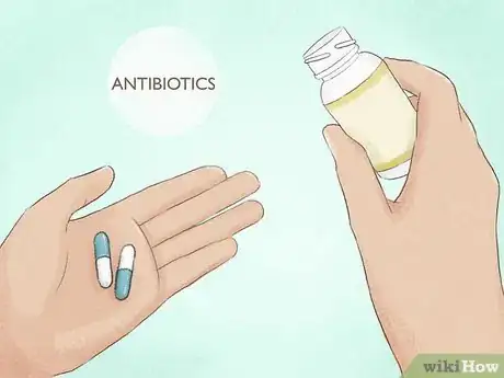 Image titled Prevent Cysts Step 3