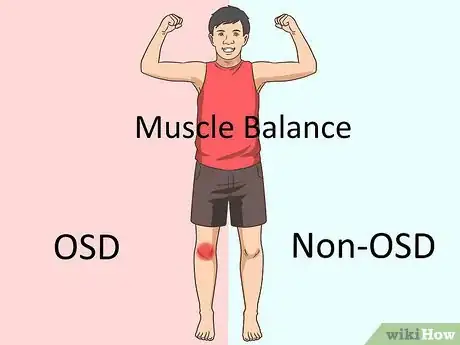 Image titled Deal With Osgood Schlatter Disease Step 15