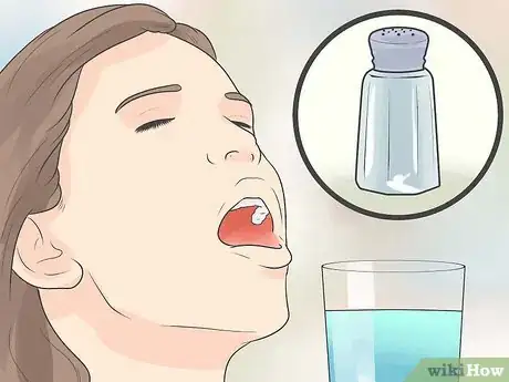 Image titled Relieve an Impacted Tooth Step 6