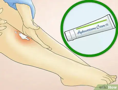 Image titled Reduce Redness After Waxing Step 8