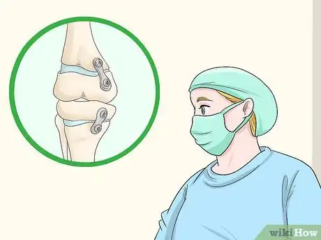 Image titled Fix Knock Knees Step 4