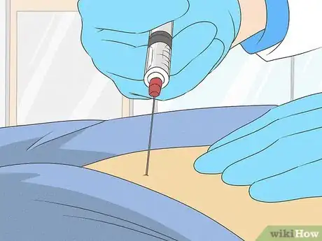 Image titled Treat Chronic Back Pain with Radio Waves Step 3