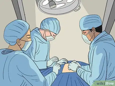 Image titled Deal with Amniotic Band Syndrome Step 5