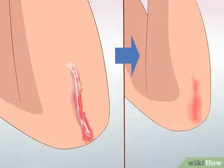 Image titled Benefit from Red Light Therapy Step 8