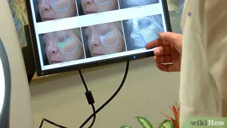 Image titled Even Out Skin Complexion Step 18