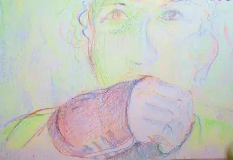 Image titled Surgeryhand