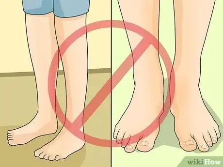 Image titled Avoid Heel Pain and Plantar Fasciitis Step 4