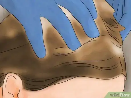 Image titled Get Rid of Lice With Orange Juice Step 6