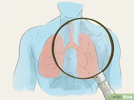 Image titled Test for Tuberculosis Step 9