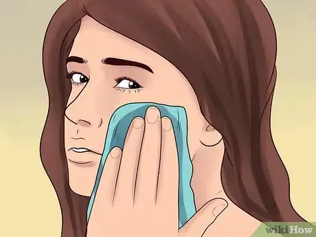 Image titled Treat Cystic Acne Step 3