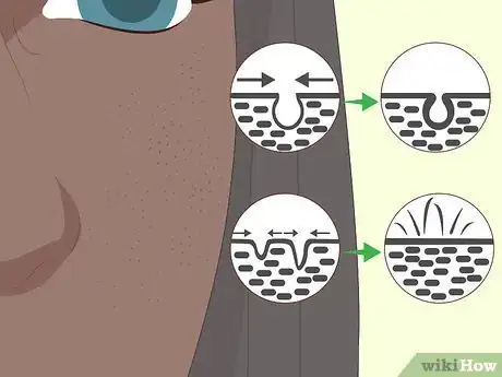 Image titled Use Ben Nye Banana Powder Step 15