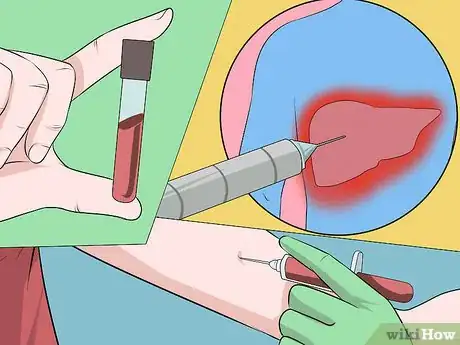 Image titled Diagnose Viral Hepatitis Step 5