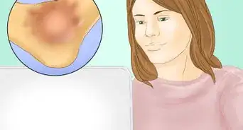 Lower Uric Acid Levels with Diet