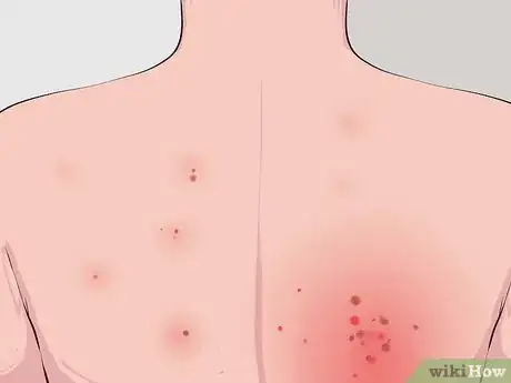 Image titled Buy a Medical Alert Bracelet Step 1