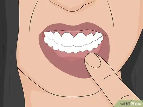 Image titled Home Treat a Toothache or Any Minor Mouth Infection Step 23