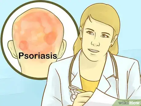 Image titled Prevent Dry Scalp Step 17