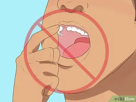 Image titled Take Care of Your Loose Teeth Step 10