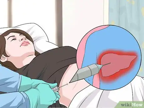 Image titled Diagnose Viral Hepatitis Step 9