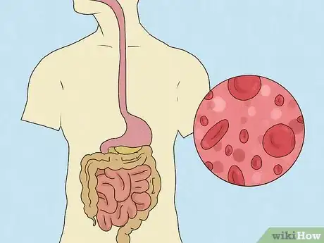 Image titled Treat Macrocytic Anemia Step 12