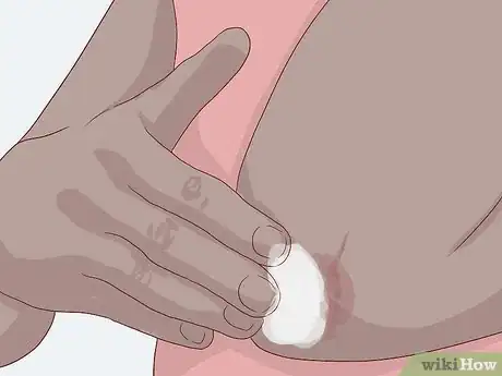 Image titled Determine Fitzpatrick Skin Type Step 17