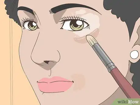 Image titled Diagnose and Treat Facial Vitiligo Step 13