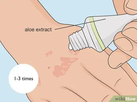 Image titled Control Psoriasis Step 05