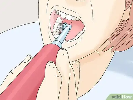 Image titled Clean Wisdom Teeth Step 3