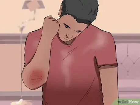 Image titled Care for a Cut Step 11