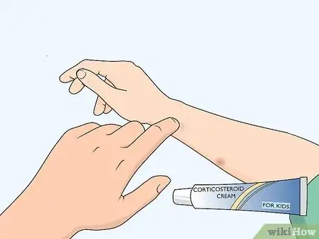 Image titled Treat Insect Bites in Toddlers Step 2
