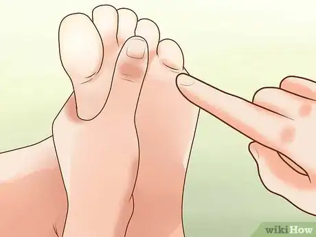 Image titled Prevent Frostbite Step 36