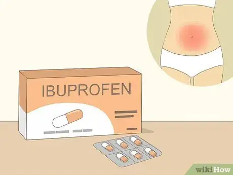 Image titled Treat Menorrhagia Step 1