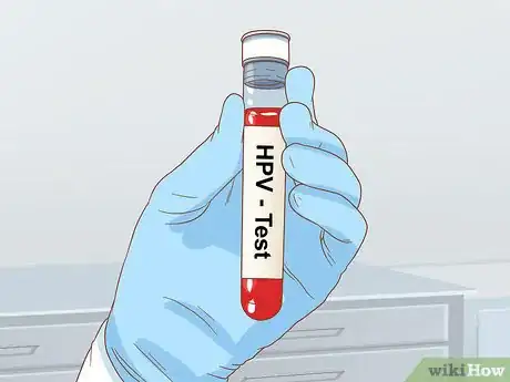 Image titled Test for HPV Step 3