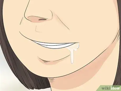 Image titled Diagnose Bell's Palsy Step 3