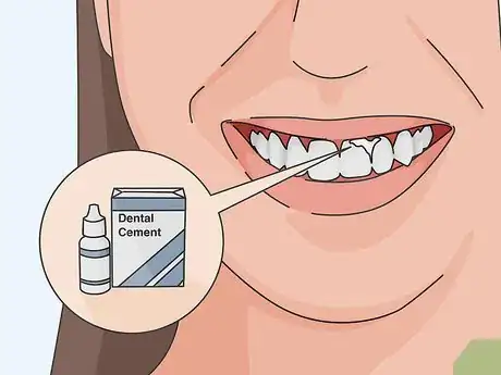 Image titled Deal with the Pain from a Chipped Tooth Step 6