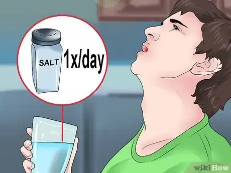 Image titled Be Happy with Braces Step 7