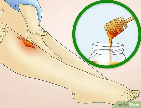 Image titled Reduce Redness After Waxing Step 7