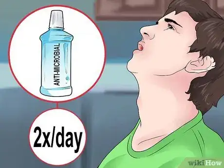 Image titled Prevent Plaque Step 5