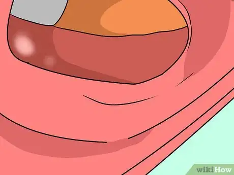 Image titled Remove a Dent from a Vehicle's Bumper Cover Step 4