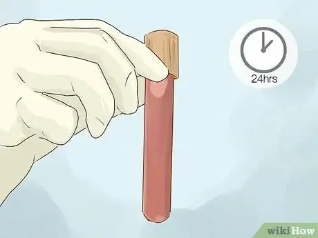 Image titled Test for Tuberculosis Step 8