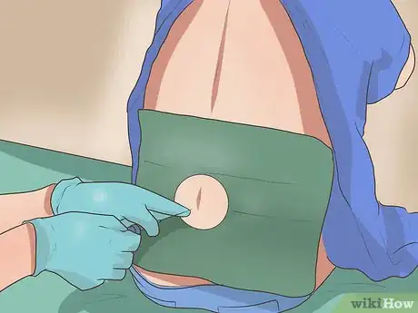 Image titled Diagnose Valley Fever Step 9