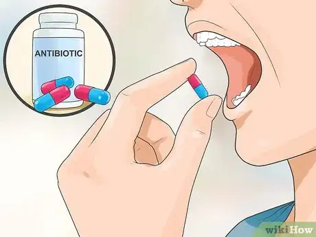 Image titled Prevent Gonorrhea Step 6