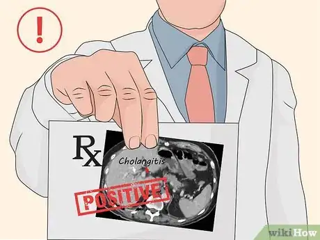 Image titled Treat Cholangitis Step 01