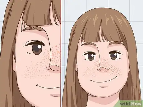 Image titled Benefit from Red Light Therapy Step 5