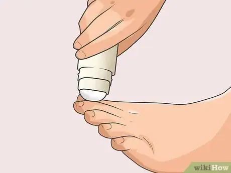 Image titled Prevent Foot Odor Step 10