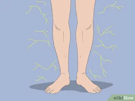 Image titled Diagnose and Treat a Pinched Nerve in Your Back Step 4