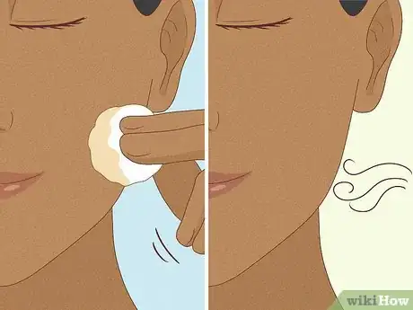 Image titled Clean Your Face to Prevent Pimples Step 18