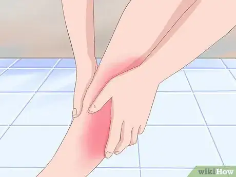 Image titled Benefit from Red Light Therapy Step 9